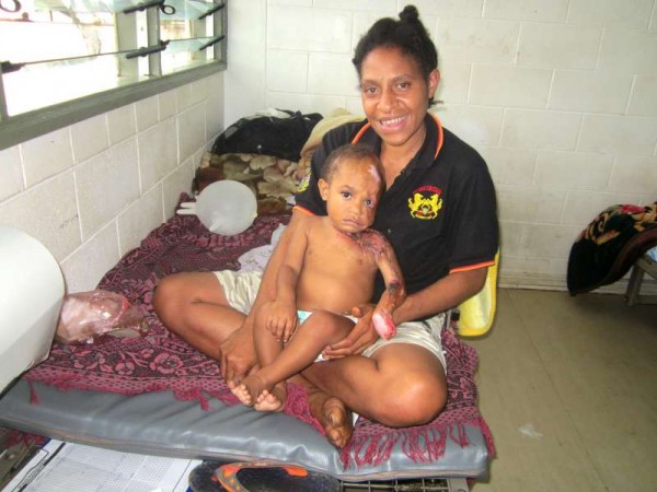 A happy little James and mother Serah at the surgical ward of Mt Hagen Hospital.