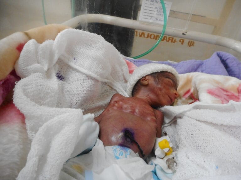 Miracle Frank born at 1kg