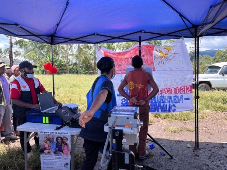 First CAD4TB x‑ray taken for a volunteer during launch at Pope’s Oval